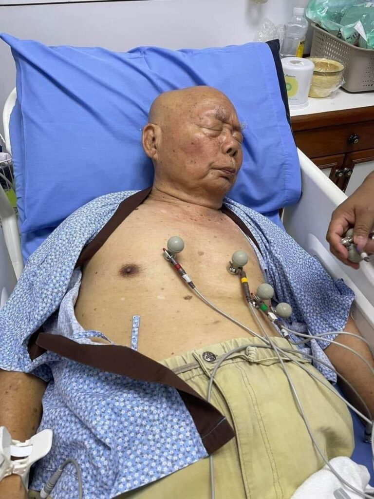 အသက် (၉၀) ရှိပြီဖြစ်သည့် KNU ဥက္ကဋ္ဌ ဗိုလ်ချုပ်ကြီး မူတူးစေးဖိုး ထိုင်းတွင် ဆေးကုသမှုခံယူနေရ