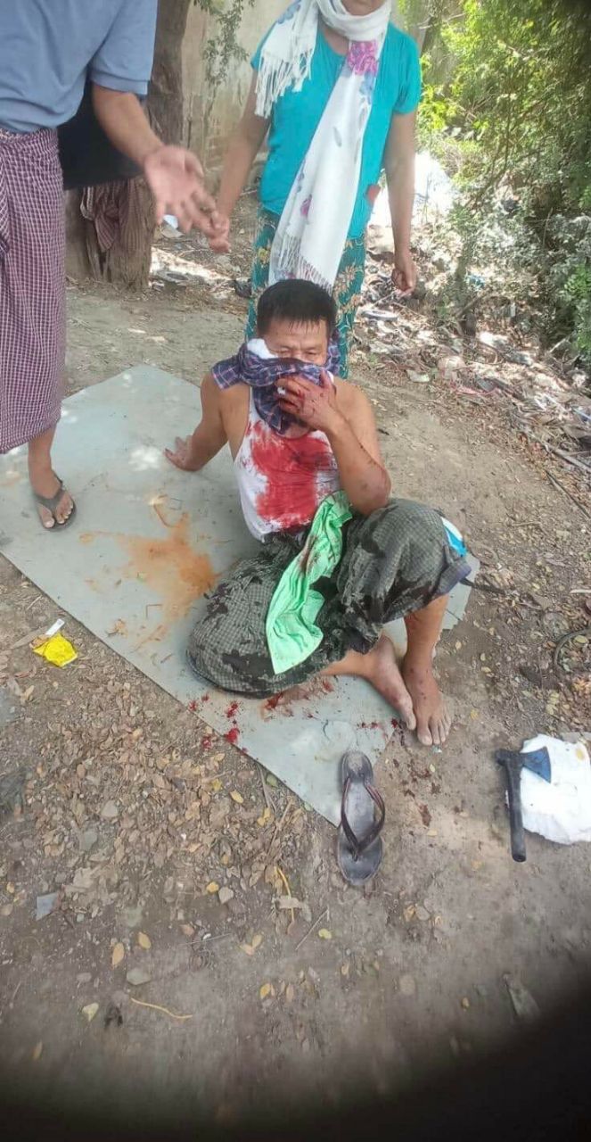 မန္တေလး၊ပြည်ကြီးတံခွန်တွင် အမျိုးသားကြီးတစ်ဦးအား ပုဆိန်ဖြင့်ခုတ်၍ ဆိုင်ကယ်လုယက်သွား
